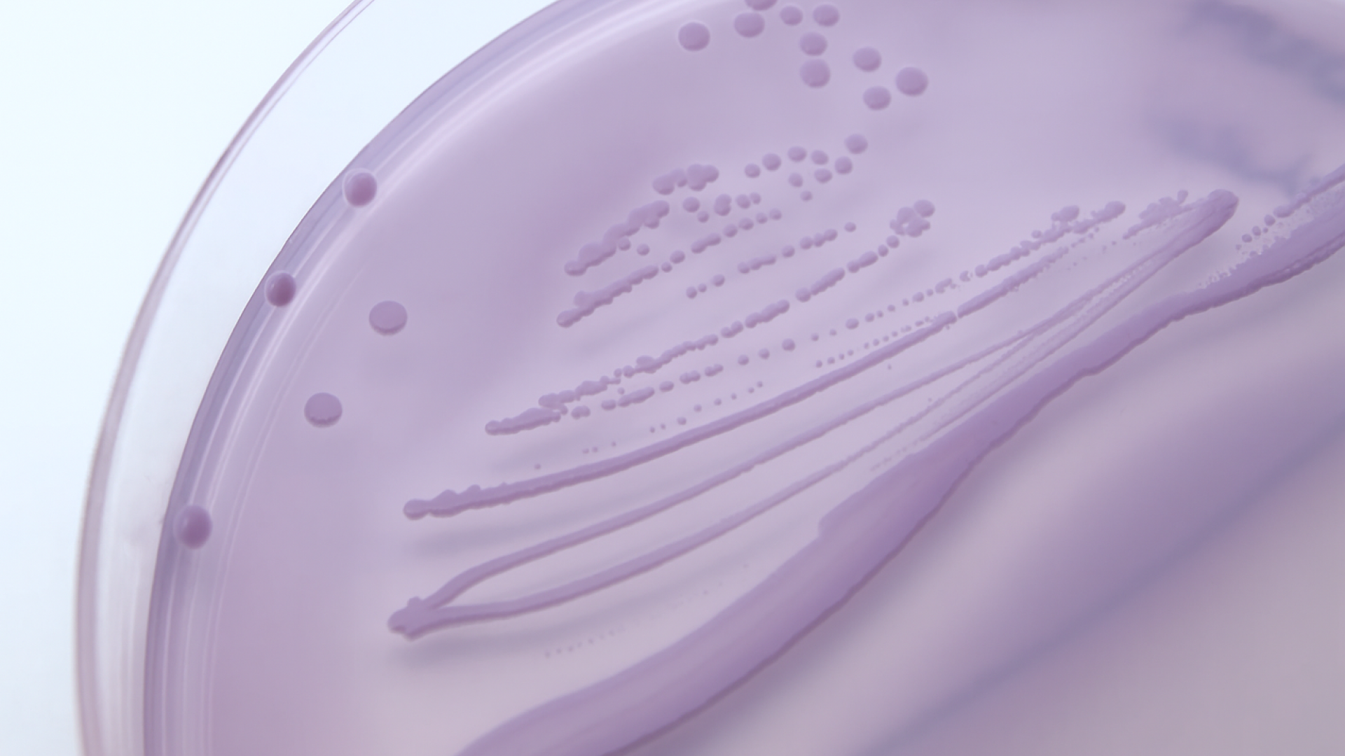 Are at-home UTI tests accurate? Here’s what you need to know